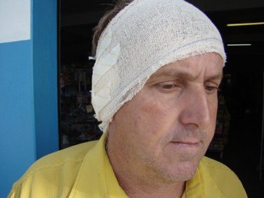 crime-inacreditavel-assaltante-morde-a-orelha-da-vitima-1