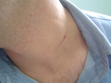 Roubo e agressão: Dupla é presa após assalto a posto