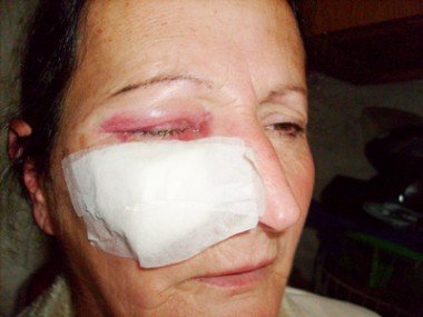 Maria da Penha: Marido espanca esposa em Tubarão