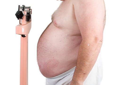 Obesos terão atendimento prioritário