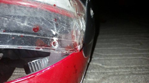 jovem-e-baleado-na-cabeca-1 A bala atravessou o capacete e acertou a face do rapaz que trabalhava como entregador - Foto:Divulgação/Notisul