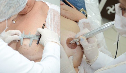 autoestima-e-resgatada-com-tatuagem-1 Sensibilizada com as experiências de mulheres, Tayse faz o trabalho gratuito - Foto:Luana Mendes/Divulgação/Notisul