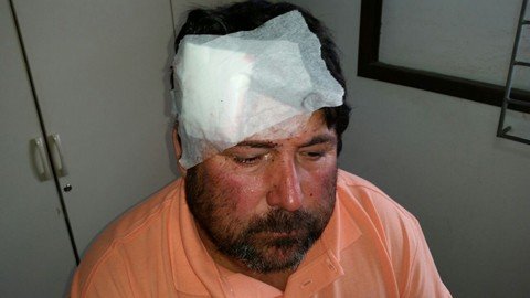 Homem leva golpe com barra de ferro