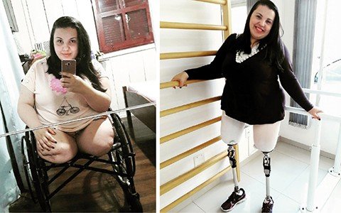 isamara-e-icone-de-superacao-1 Isamara perdeu as pernas após um acidente. Ela está em período de reabilitação para uso das próteses. Fotos: Arquivo pessoal/Divulgação/Notisul.
