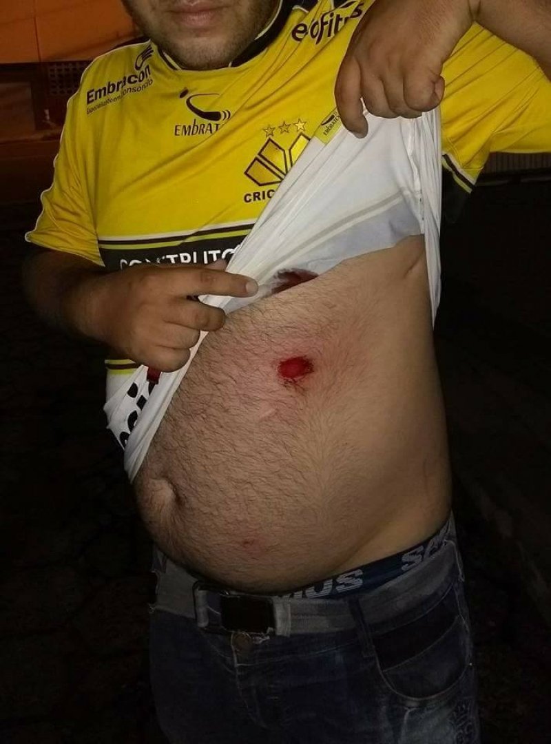 torcedor-e-ferido-por-bala-de-borracha-em-confusao-apos-jogo-do-criciuma-1