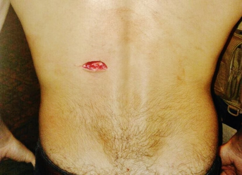 vitima-e-esfaqueada-durante-roubo-em-tubarao-1