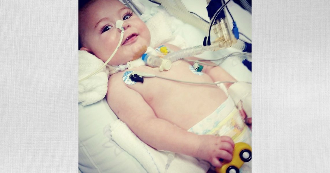 tubaronenses-realizam-campanha-para-bebe-com-sindrome-rara-1