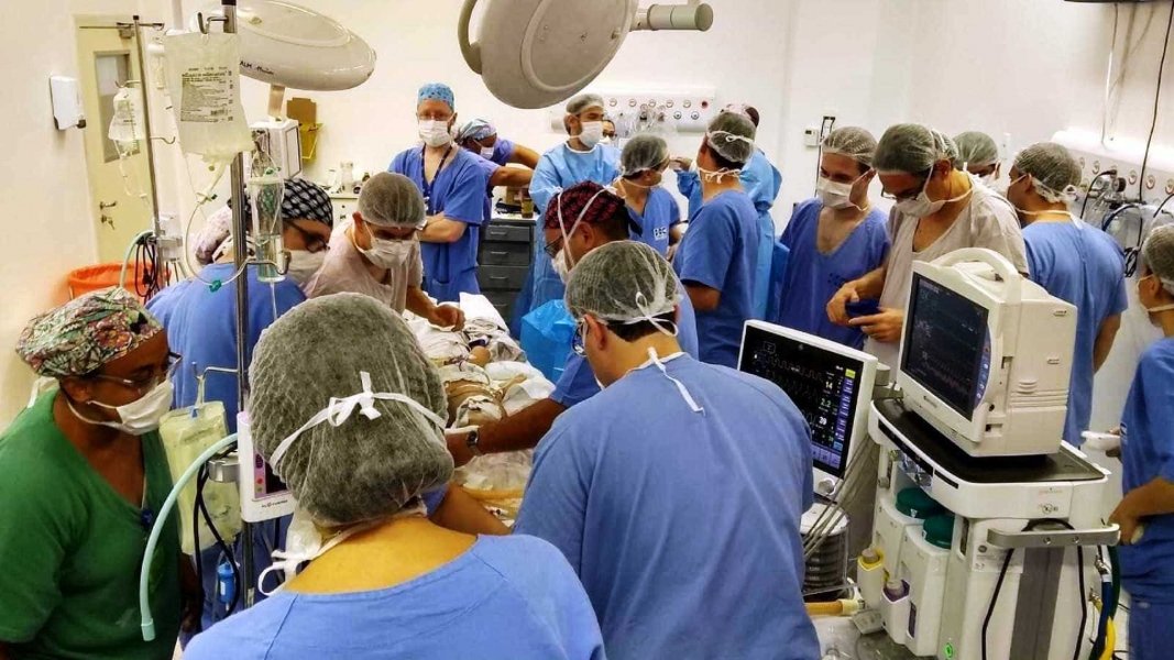 irmas-siamesas-unidas-pela-cabeca-se-recuperam-apos-cirurgia-1