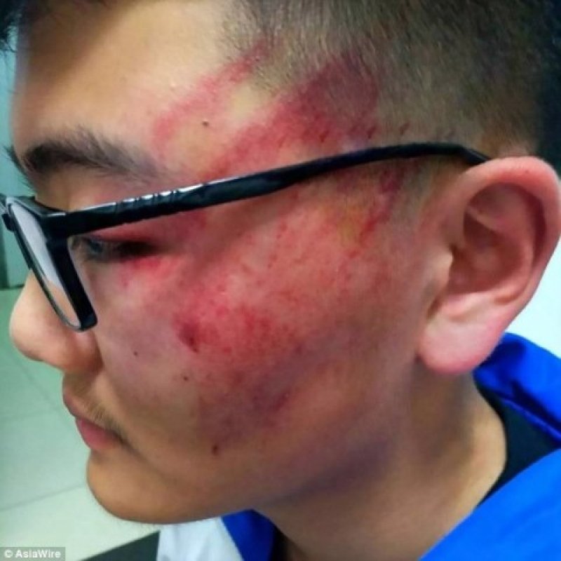 china-professora-deixa-aluno-com-ferimentos-graves-apos-lhe-dar-bofetadas-1