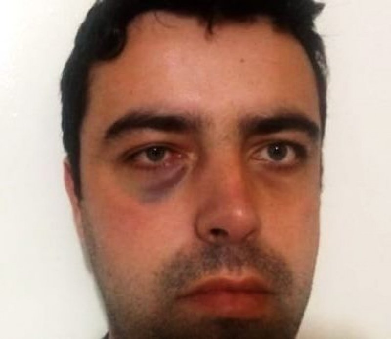 professor-e-agredido-por-aluno-em-escola-de-curitibanos-1