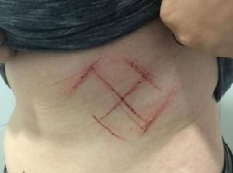 nao-e-uma-suastica-diz-delegado-sobre-corte-em-corpo-de-jovem-1