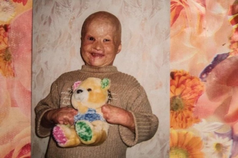 a-historia-do-menino-jogado-no-forno-pelo-pai-bebado-1