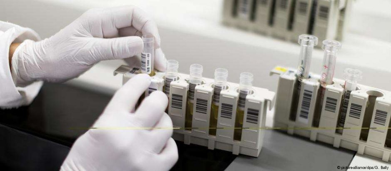 paciente-em-londres-pode-ser-segundo-caso-de-cura-do-hiv-1