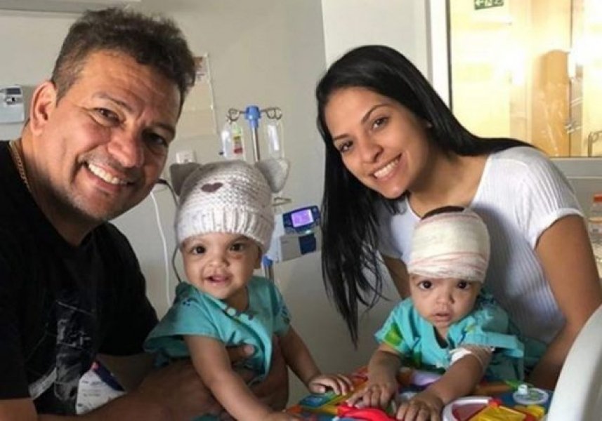 lis-a-segunda-siamesa-separada-por-cirurgia-recebe-alta-da-uti-1