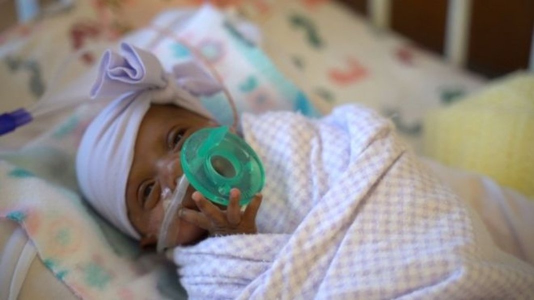 menor-bebe-do-mundo-a-sobreviver-deixa-hospital-e-vai-para-casa-nos-eua-1