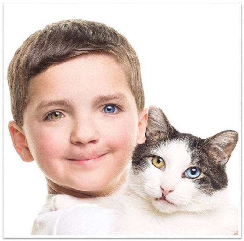 menino-adota-gato-com-os-mesmos-olhos-e-labio-leporino-dele-1