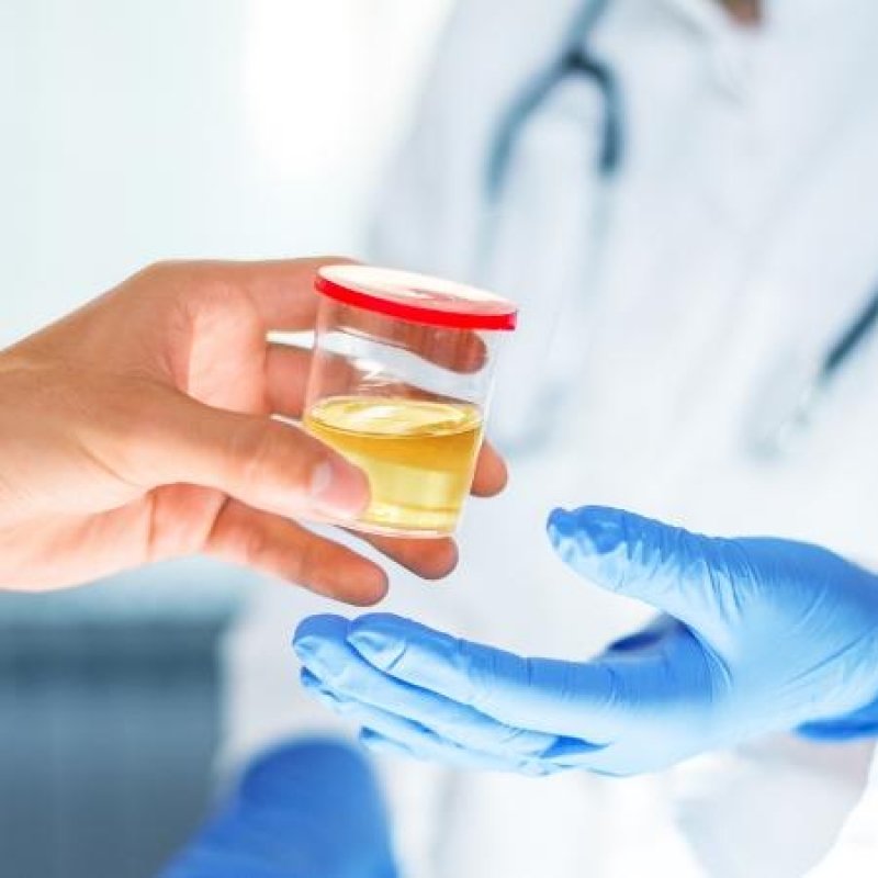 estudo-possibilita-identificar-cancer-de-prostata-atraves-da-urina-1