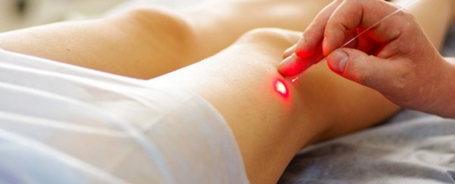 laser-mata-celulas-cancerigenas-do-sangue-em-tempo-real-1