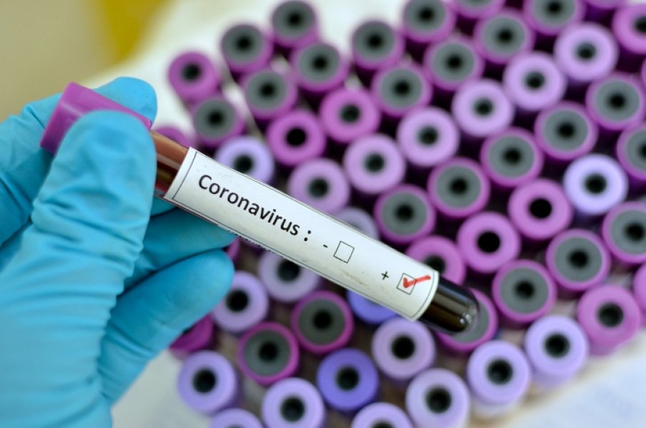 coronavirus-braco-do-norte-confirma-segundo-caso-da-doenca-1