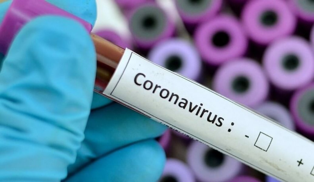 em-imbituba-canal-com-a-sociedade-ira-esclarecer-duvidas-sobre-o-coronavirus-1