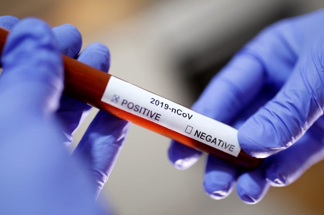 novocoronavirus