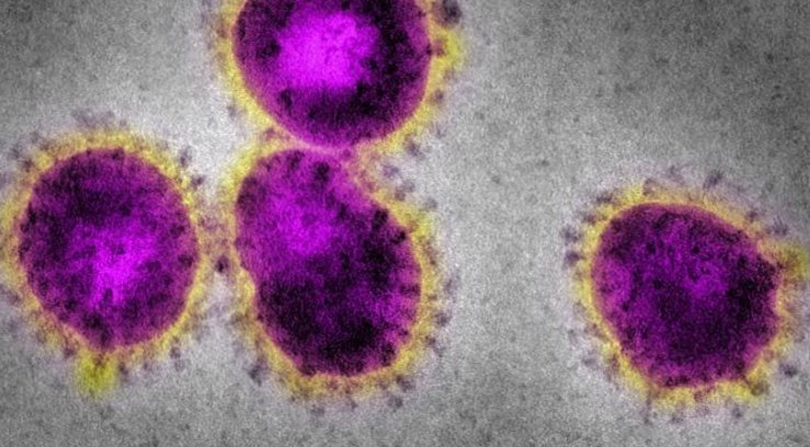 Braço do Norte registra 815 casos confirmados de Covid-19; foram 64 a mais nas últimas 24 horas