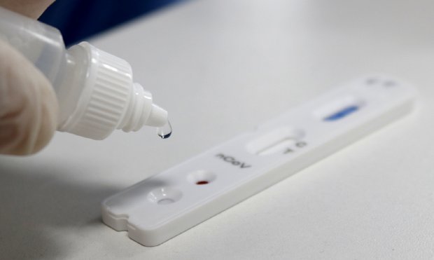 Braço do Norte volta a ter alta nos casos de Covid-19, foram 53 nas últimas 24 horas. Ao todo são 751 casos confirmados