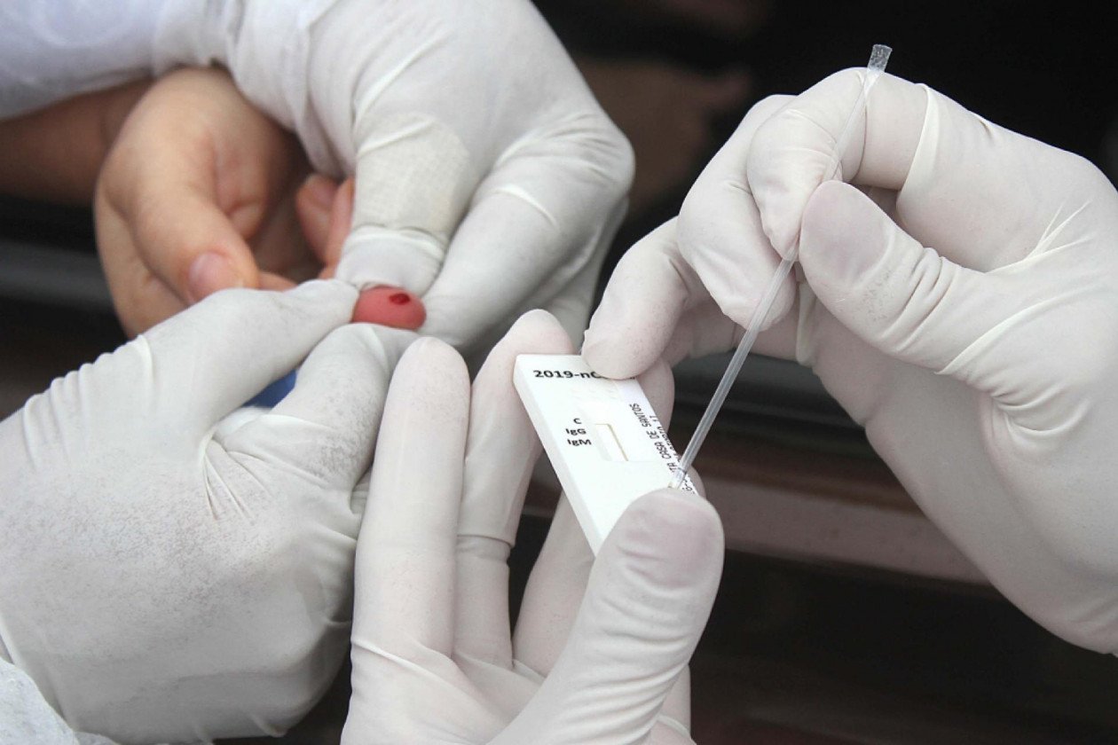 Número de casos confirmados sobe para 346 em Imbituba; Hoje mais 15 testaram positivo