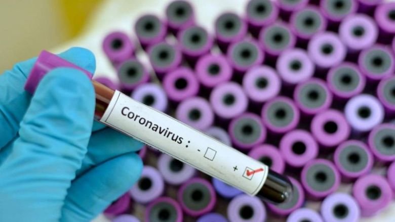 Pescaria Brava registra 104 casos confirmados de Covid-19, 62 pacientes já estão recuperados.