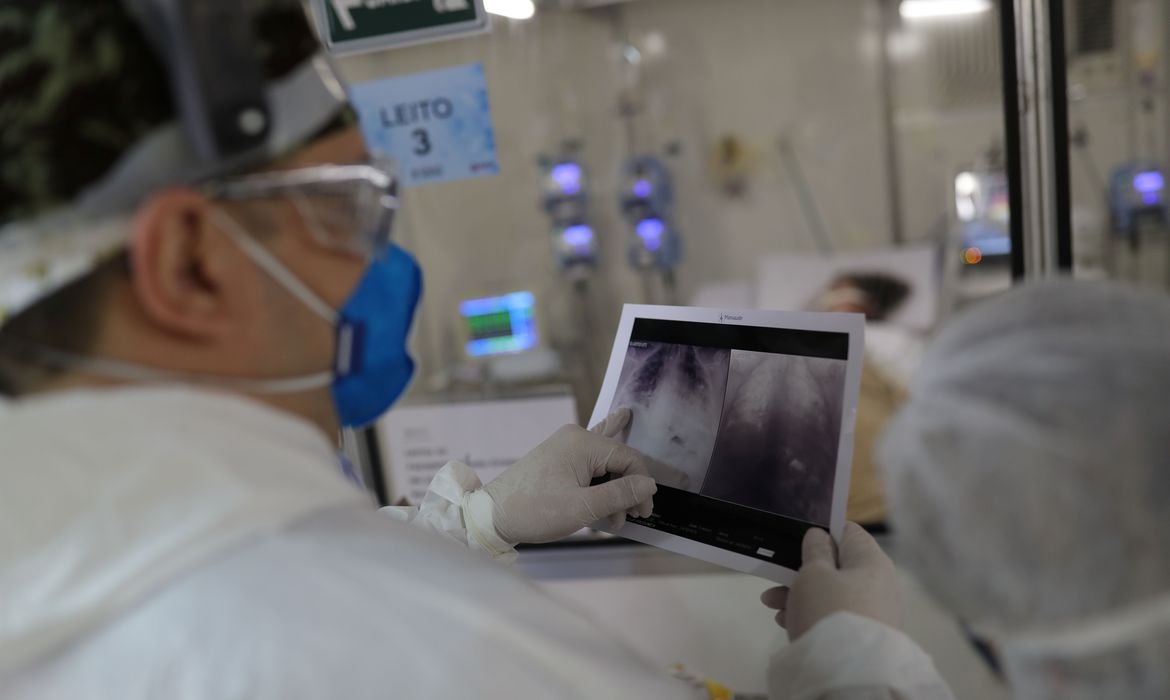 radiografia_de_torax_covid-19