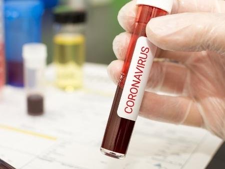 teste-de-coronavirus