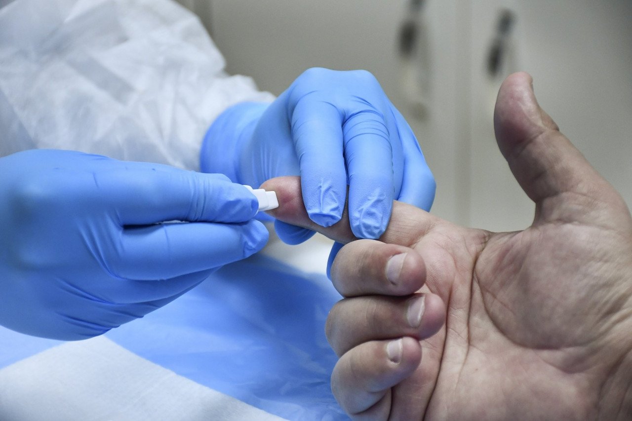 Braço do Norte oficial 50 casos