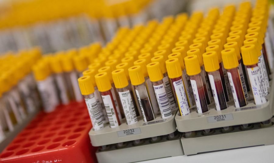 Covid 19 #Pracegover Foto: na imagem há várias embalagens com testes de Covid-19