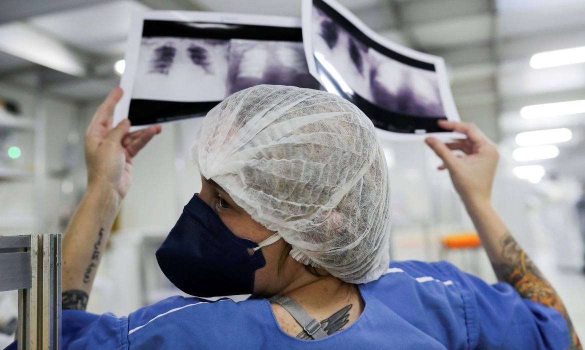 radiografia_de_torax