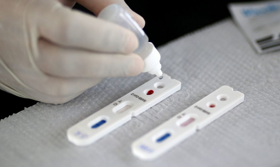 teste #Pracegover Foto: na imagem há a mão de uma pessoa com luvas, um frasco com líquido e dois testes de Covid