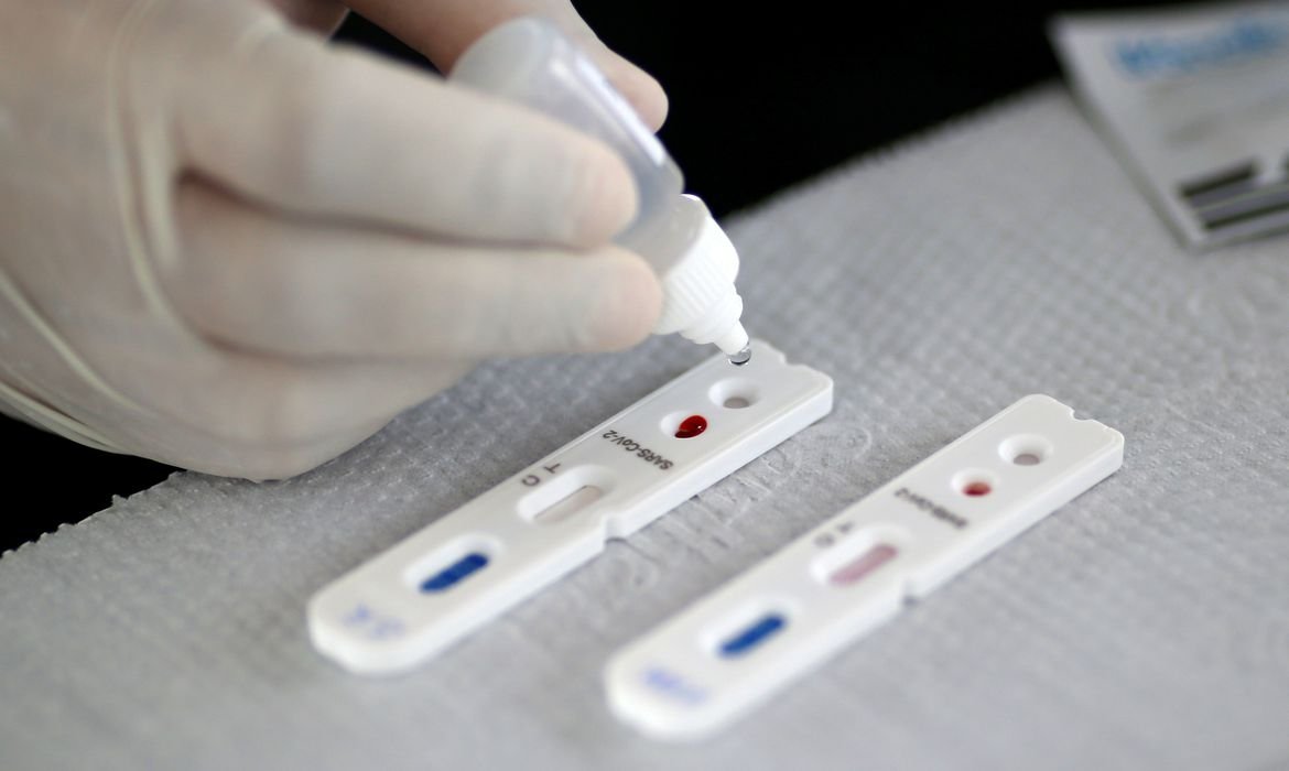 teste #Pracegover Foto: na imagem há a mão de uma pessoa com luvas, um frasco com líquido e dois testes de Covid