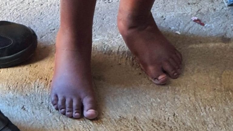 Criança de 11 anos era mantida acorrentada dentro de barril pela família em Campinas