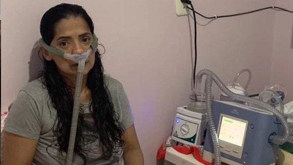 Amigos fazem vakinha na internet para ajudar tubaronense diagnosticada com lúpus #Pracegover Na foto, Edinéia Silva aparece usando um respirador
