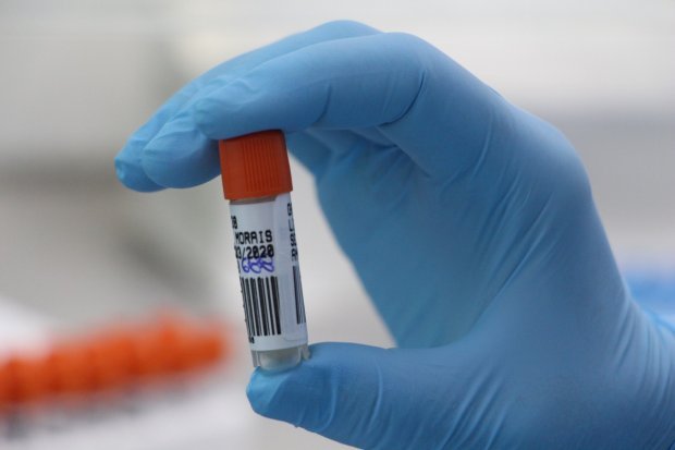 Governo de SC investiga 12 casos suspeitos de reinfecção por Covid-19