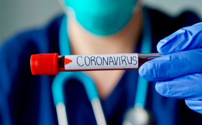 coronavirus #Pracegover Foto: na imagem há uma pessoa com luvas segurando o teste positivo para covid