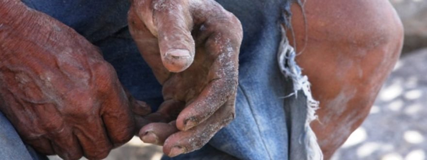 trabalho escravo #Pracegover Foto: na imagem há as mãos e a perna de uma pessoa