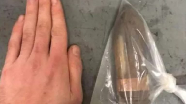 Hospital aciona equipe antibomba para receber homem com bala de canhão no ânus