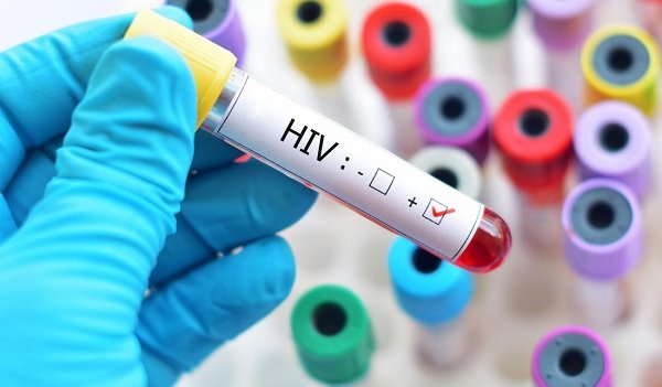HIV-Aids #ParaTodosVerem Na foto, um tubo de ensaio com sangue. Na frente há uma etiqueta onde está escrito HIV+