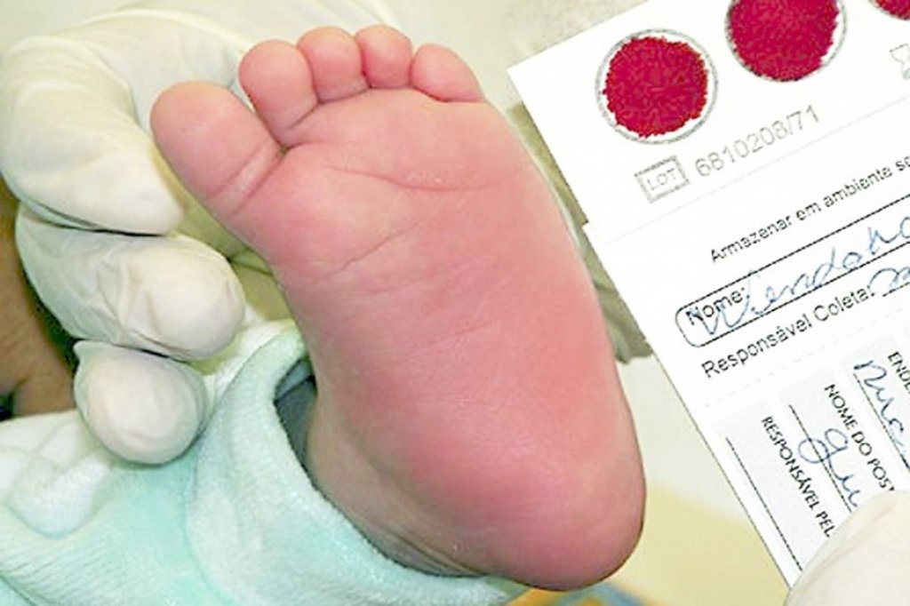 pezinho Teste do pezinho é descentralizado em Balneário Gaivota