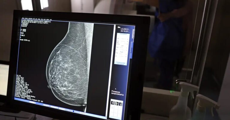 Tubarão amplia acesso à mamografia durante o Março Lilás