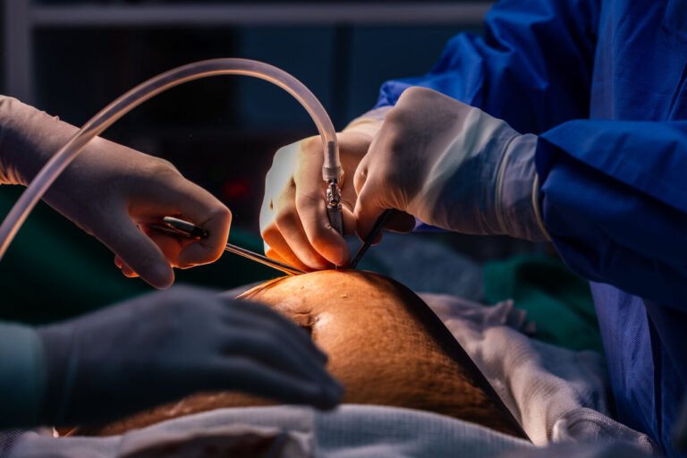 cirurgias bariátricas SC